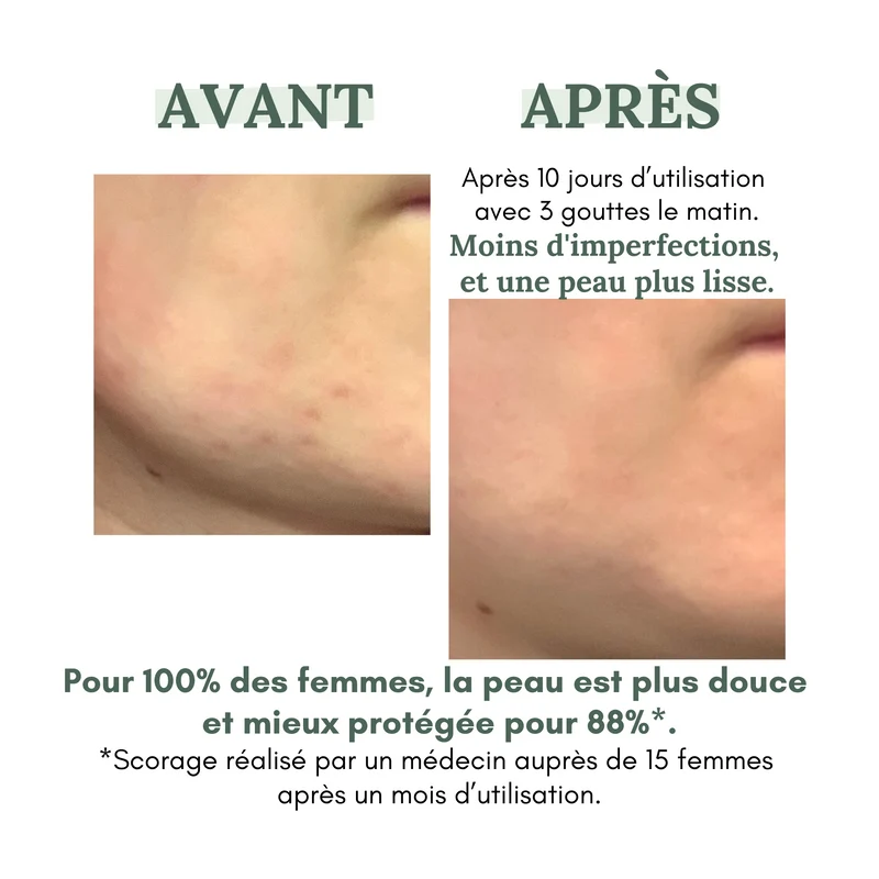 Sérum anti-imperfections DAY